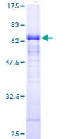 Human HAT1 Protein (Recombinant GST)