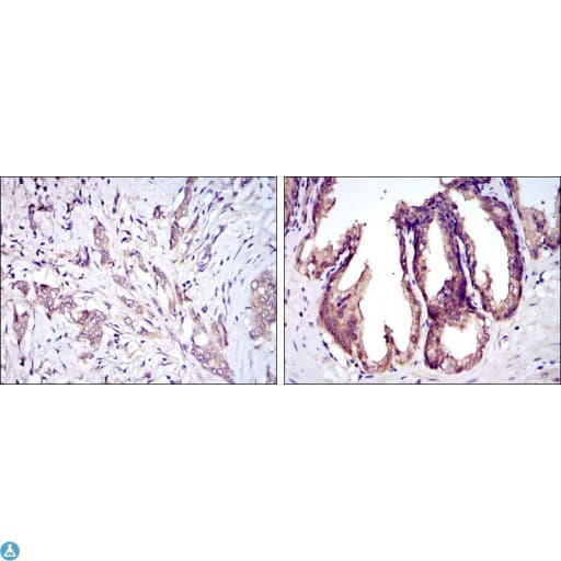 MAP3K5 / ASK1 Antibody