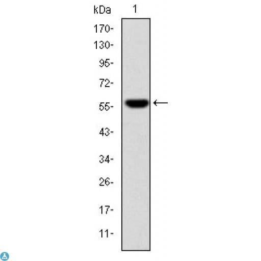 FGG / Fibrinogen Gamma Antibody