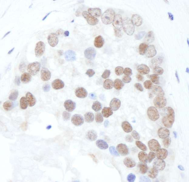 Polyclonal Rabbit anti-Human XRCC1 Antibody (phospho-Ser518 / phospho-Thr519/523, IHC, WB)