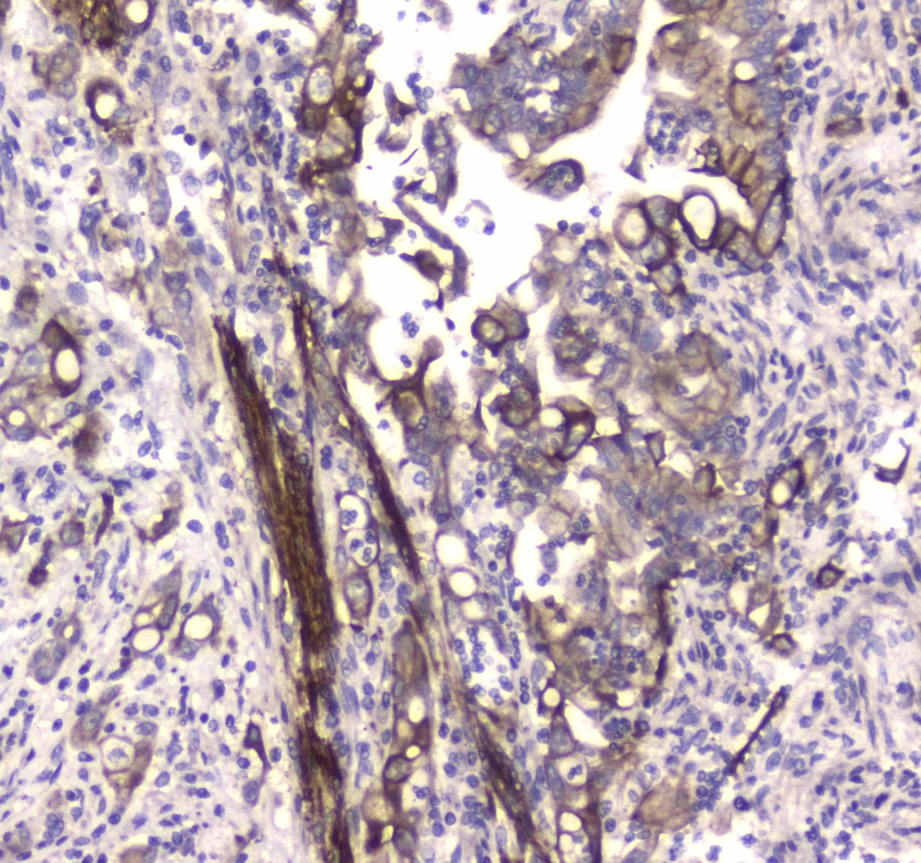 MAP1LC3A / LC3A Antibody