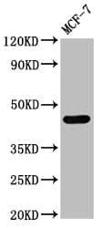 CASQ2 / Calsequestrin 2 Antibody