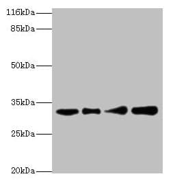 RSU1 Antibody