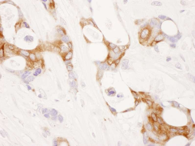 PTGS2 / COX2 / COX-2 Antibody (aa554-604)