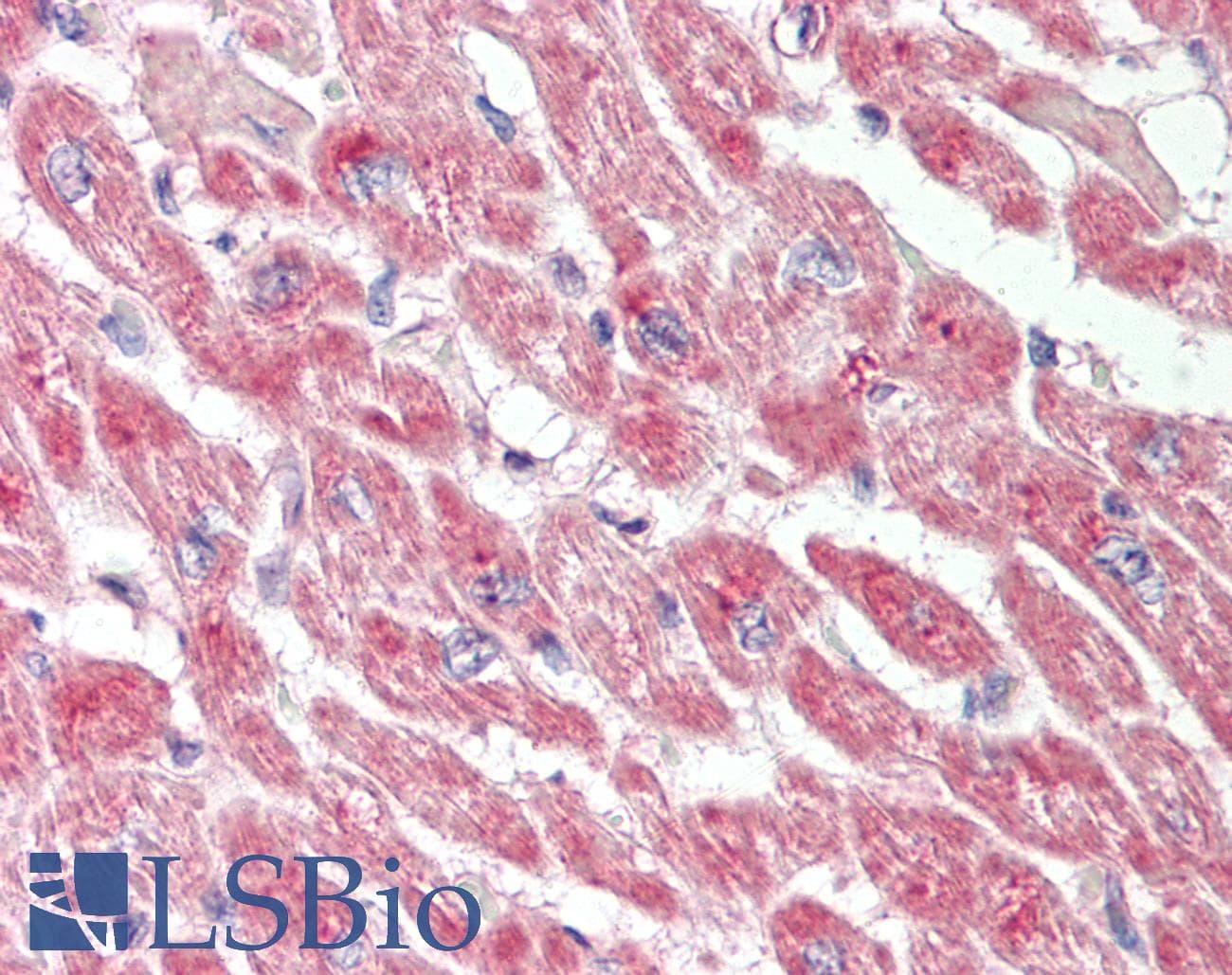 ACOT11 / THEA Antibody (aa215-264)