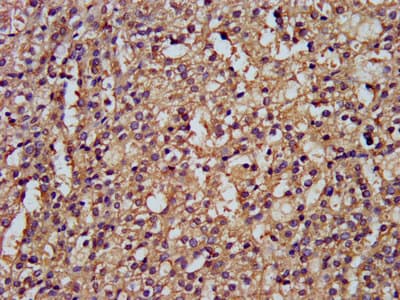 Polyclonal Rabbit anti-Human DLST / E2 Antibody (IHC, IF, WB)