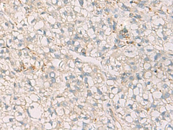 SUSD3 Antibody
