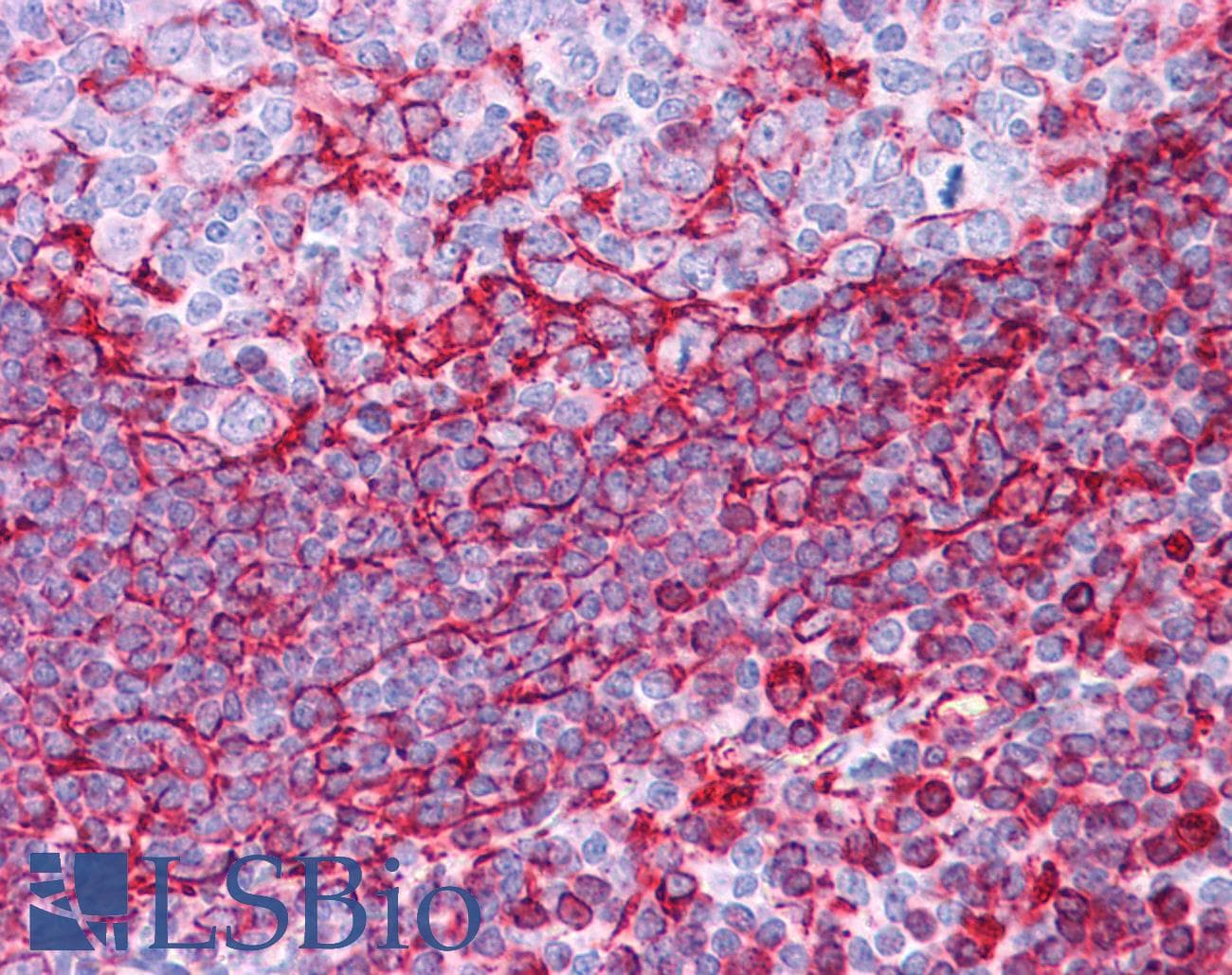 PathPlus™ Vimentin Antibody (C-Terminus)