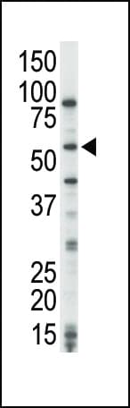 MAP3K8 / TPL2 Antibody (aa368-397)