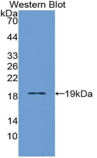 IL3RA / CD123 Antibody (aa19-157)
