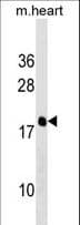 PDE6D / PDE6 Delta Antibody (aa26-55)