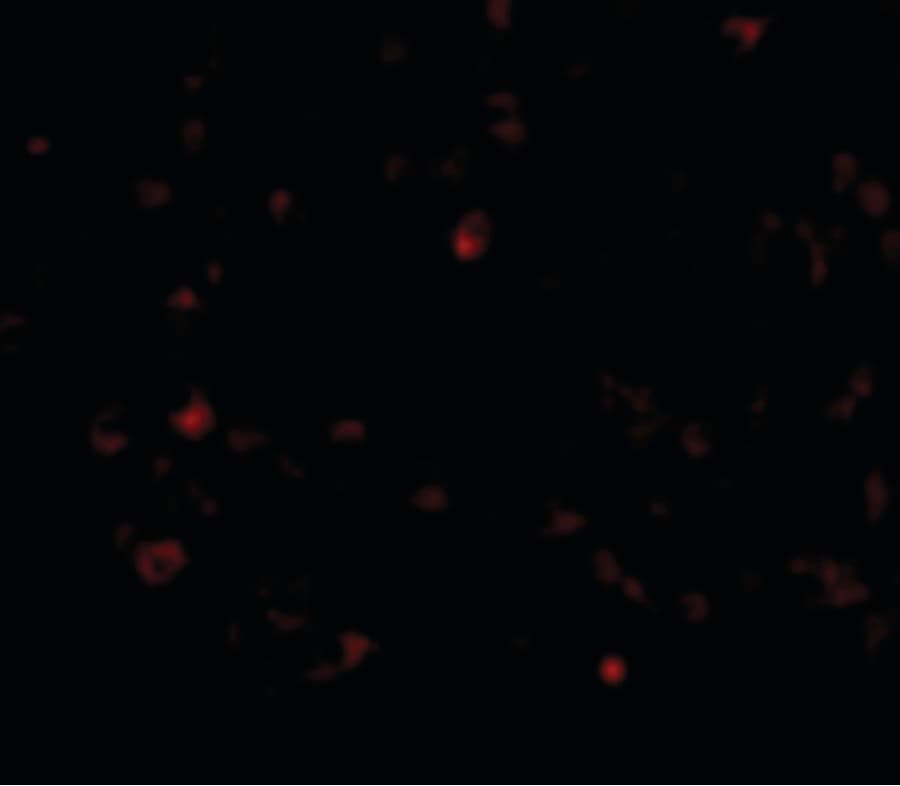 Polyclonal Rabbit anti-Human AIM / CD5L Antibody (IHC, IF, WB)