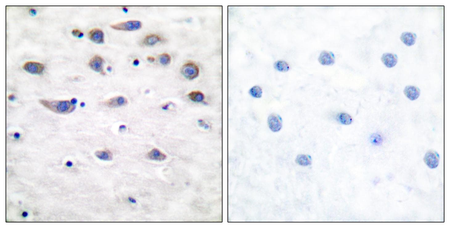 GRIA1 / GLUR1 Antibody (phospho-Ser849)