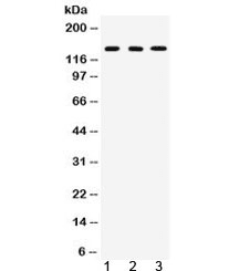 Polyclonal Rabbit anti-Human CML / BCR Antibody (WB)