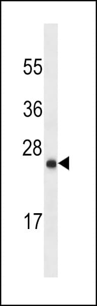 IHC-plus™ LYPD6B Antibody (aa79-108)