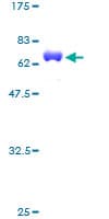 Human CKB / Creatine Kinase BB Protein (Recombinant GST)