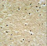 AP5Z1 Antibody (aa294-322)