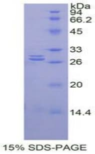 Rat GSTA1 Protein (Recombinant His)