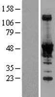 NADK / NAD Kinase Protein (Over-Expression Lysate Myc-DDK (Flag))