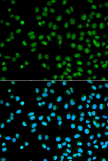 Polyclonal Rabbit anti-Human CST8 / CRES Antibody (IHC, IF, WB)