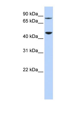 DPH2 Antibody (aa72-121)