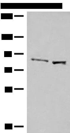 SLC26A3 / DRA Antibody