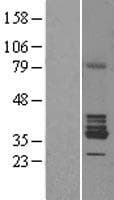 RDH1 / RDH5 Protein (Over-Expression Lysate Myc-DDK (Flag))