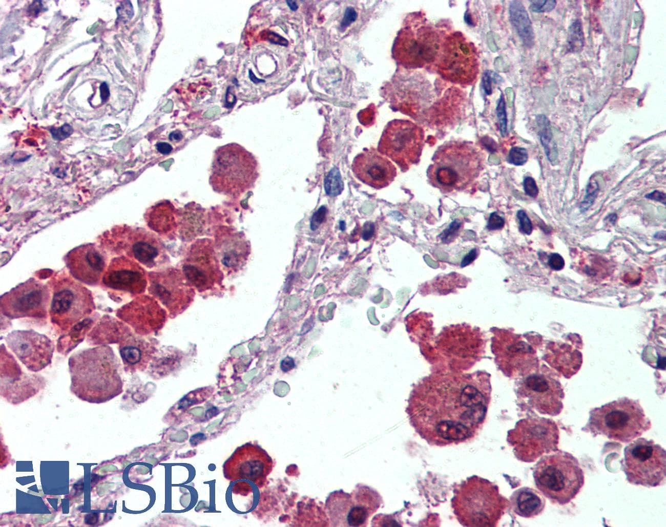 IHC-plus™ IDE Antibody (aa914-924)