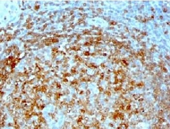 CD74 / CLIP Antibody (clone CLIP/813, Ready-to-Use)
