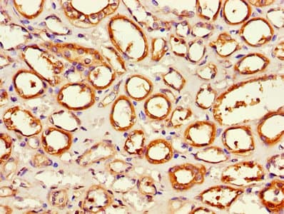 APH / APEH Antibody