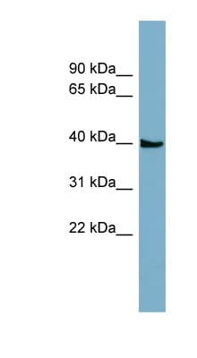 Polyclonal Rabbit anti-Human SLC35D3 / FRCL1 Antibody (aa35-84, WB)