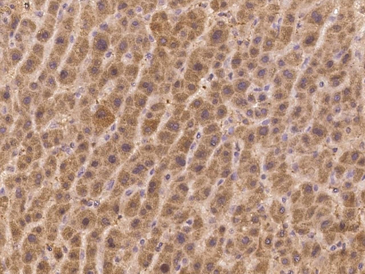 FAM9B Antibody