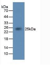 F3 / CD142 / Tissue factor Antibody (aa33-292, Biotin)