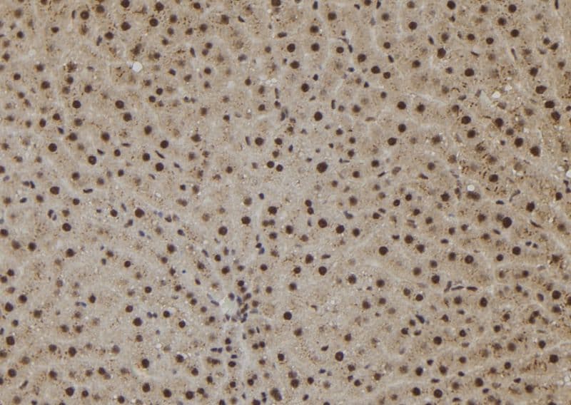 Polyclonal Rabbit anti-Human SHOC2 Antibody (IHC, WB)