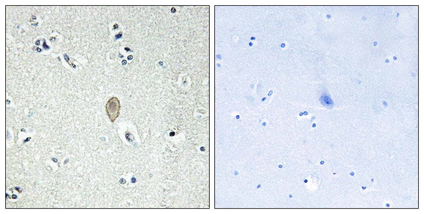 FZD5 / Frizzled 5 Antibody