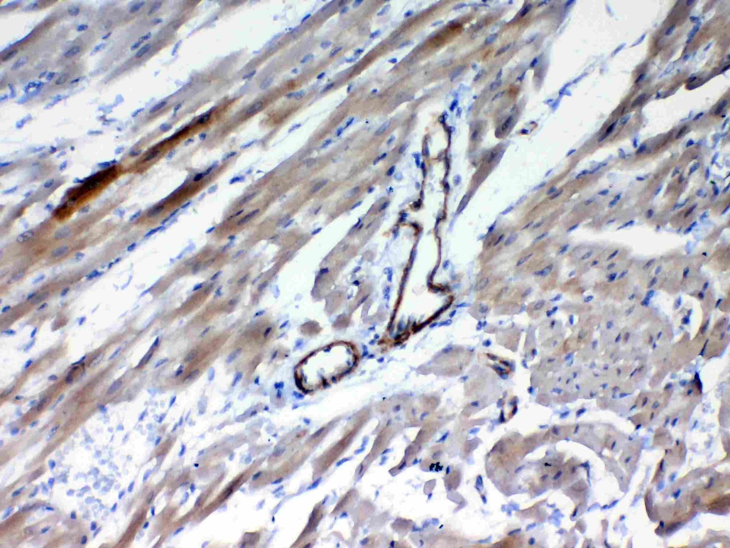 FZD4 / Frizzled 4 Antibody