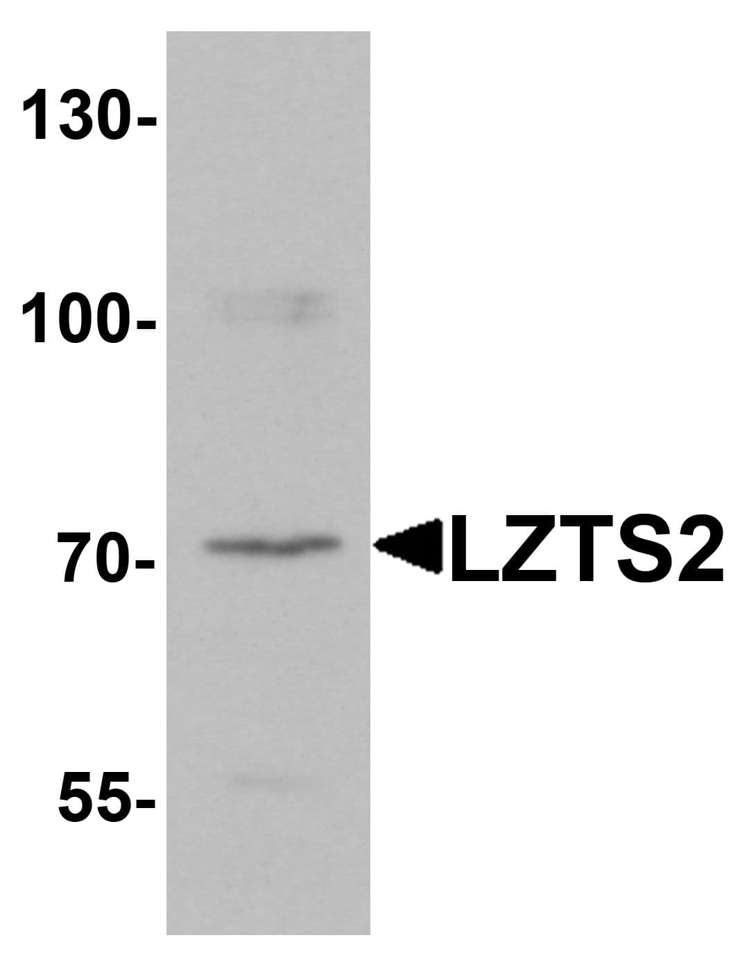 IHC-plus™ LZTS2 Antibody