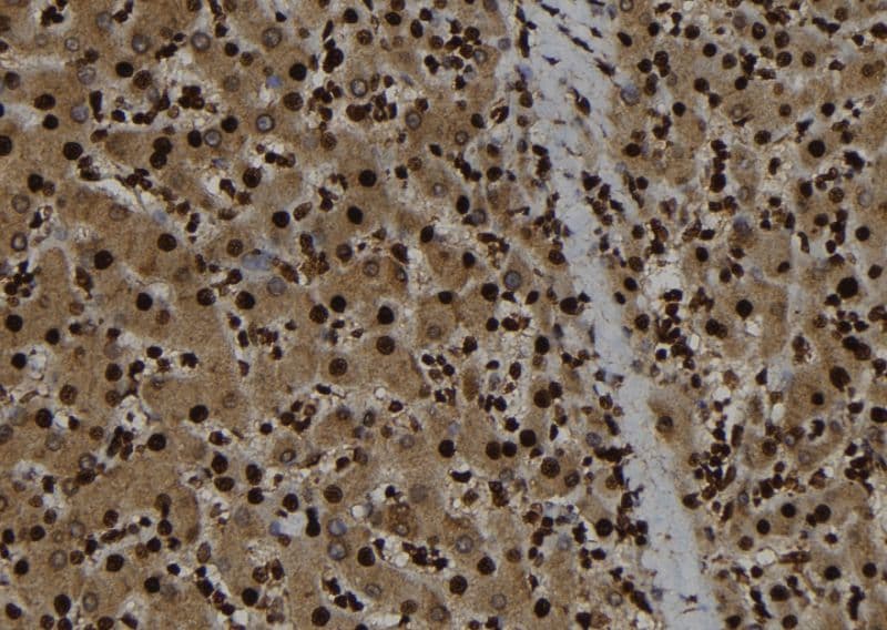 Polyclonal Rabbit anti-Human RBL1 / p107 Antibody (IHC, WB)