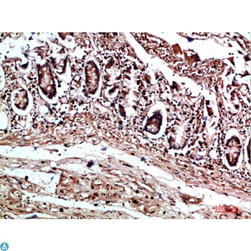 COL17A1 / Collagen XVII Antibody