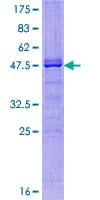 Human BMF Protein (Recombinant GST)