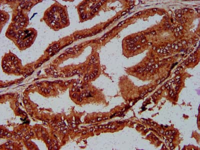 UNC84B / SUN2 Antibody