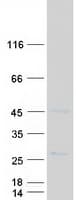 Human SLC50A1 / SCP Protein (Recombinant Myc-DDK (Flag))