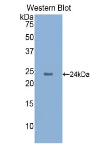 LL37 / Cathelicidin Antibody (aa31-170)