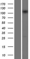 INTS5 Protein (Over-Expression Lysate Myc-DDK (Flag))