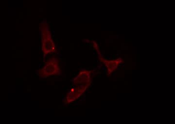 Polyclonal Rabbit anti-Human SHPK / CARKL Antibody (IHC, IF, WB)