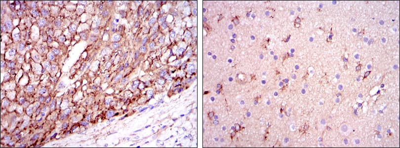 Monoclonal Mouse anti-Human APOE / Apolipoprotein E Antibody (clone 1H4, IHC, WB)