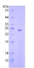 Human HMG1 / HMGB1 Protein (Recombinant His, N-Terminal)