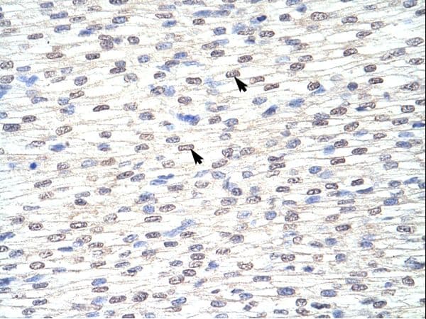 GRHL3 Antibody (aa529-578, HRP)