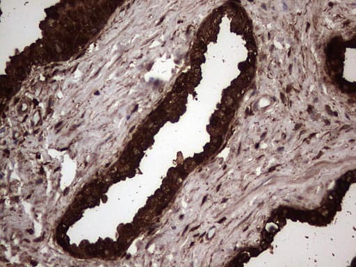 LGALS3 / Galectin 3 Antibody (clone OTI6E1)