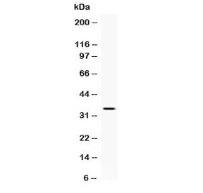 NAT1 / AAC1 Antibody